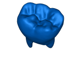 3D scalable tooth-0