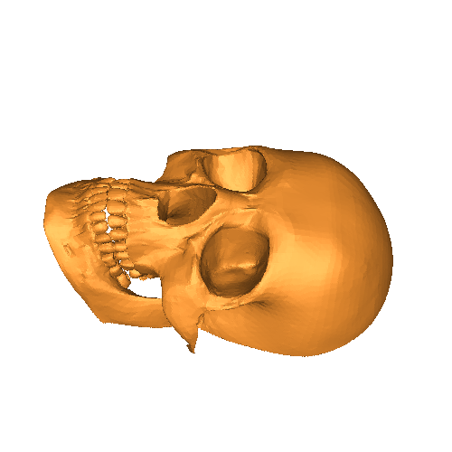 Flat skull