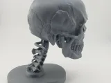 Skull Anatomy-5