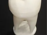 Tooth trophy-0
