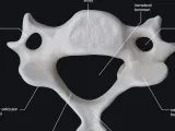 Flat C6 Vertebrae Piece -0
