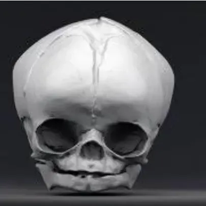 Newborn/fetus skull