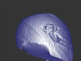 helm-1