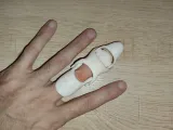 MDP 2 MIDDLE FINGER DISTAL PROSTHESIS-5