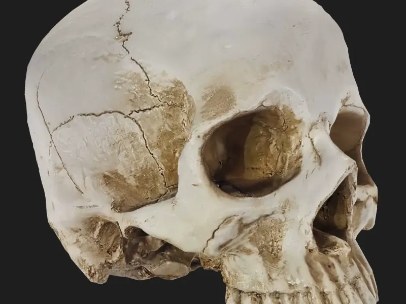 Human Skull
