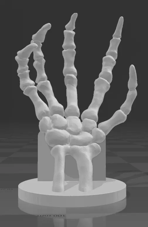 Support controller