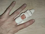 MDP LITE MIDDLE FINGER DISTAL PROSTHESIS-7