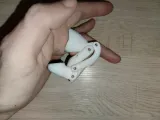 MDP 2 MIDDLE FINGER DISTAL PROSTHESIS-3