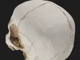 Human Skull-2