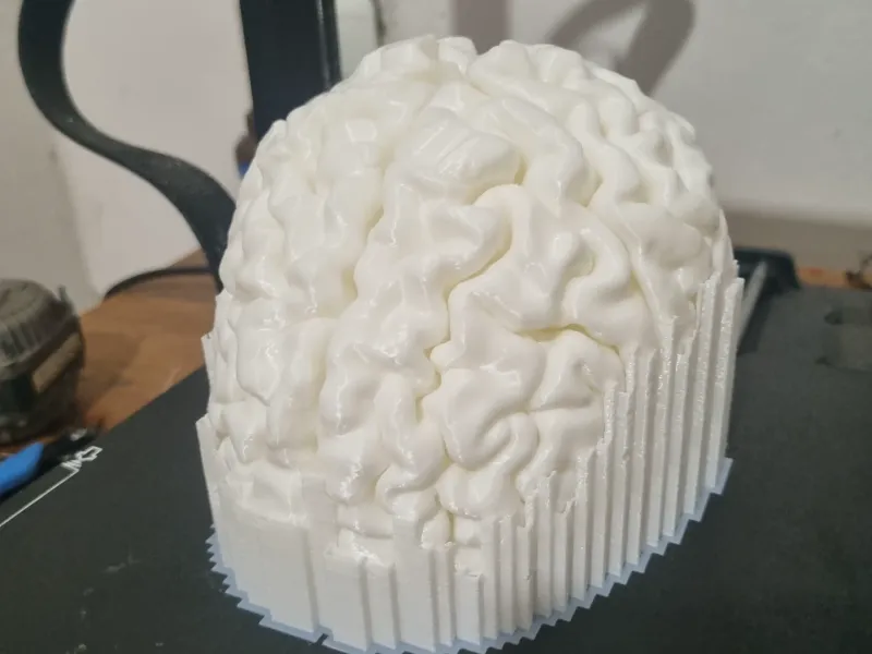 cerebro escala real