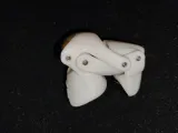 MDP 2 MIDDLE FINGER DISTAL PROSTHESIS-2