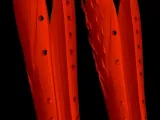 Editable Porquipine Splint-0