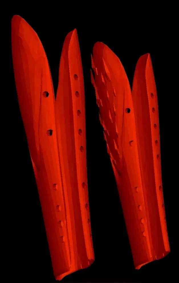 Editable Porquipine Splint