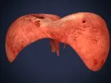 Realistic Human Diaphragm Anatomy 3D Printable Model-9