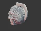 Skull with Exposed Brain 3D Print Model-5