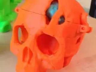 Skull and brain 