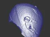 helm-2