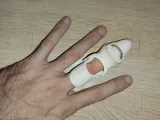 MDP 2 MIDDLE FINGER DISTAL PROSTHESIS-6
