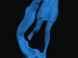 abstract 1-1