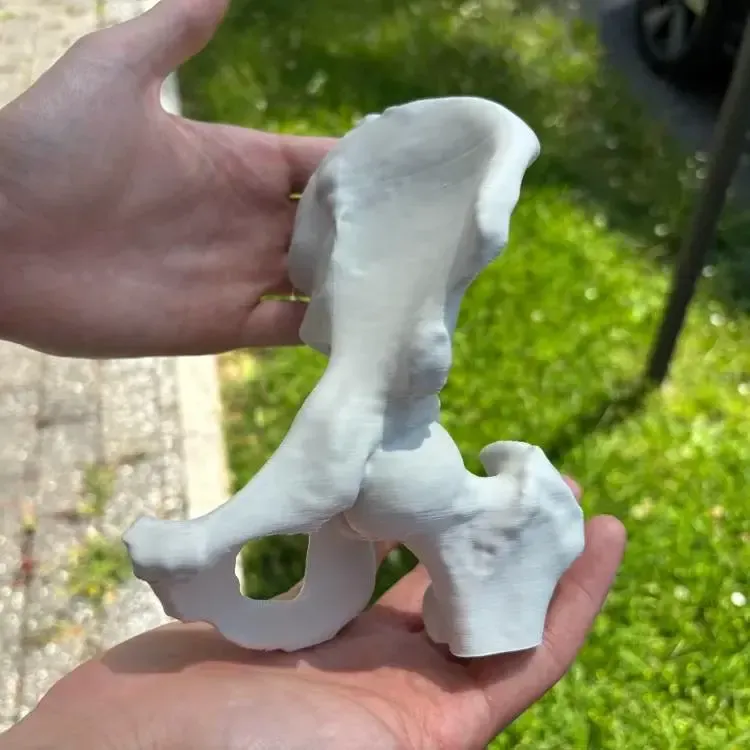 Menschliche Hüfte (Aus echtem CT-Scan)