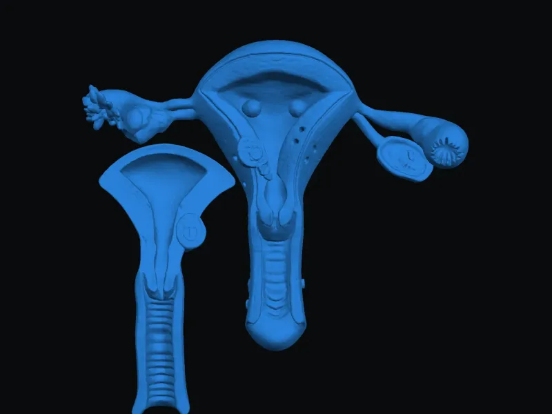 uterus -2