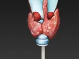 thyroid / Schilddrüse-3
