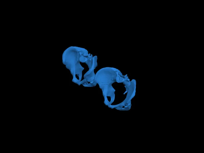 pelvis anatomi 