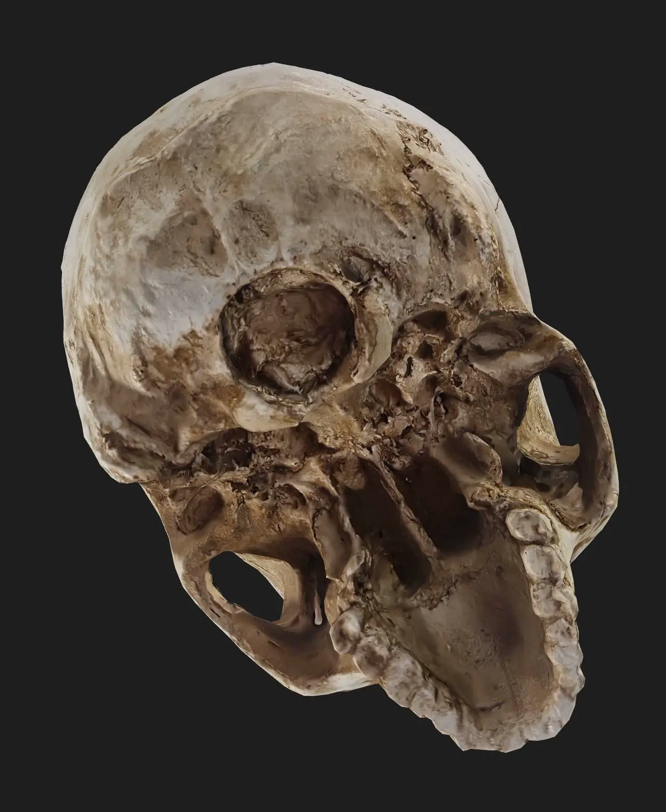 Human Skull