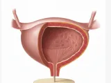urinary bladder / Harnblase-4