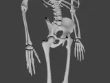Skeleton HD-2