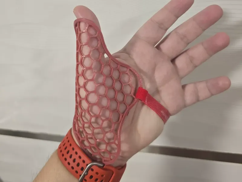 Thumb Splint
