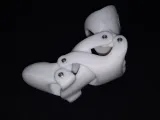 MDP LITE MIDDLE FINGER DISTAL PROSTHESIS-5