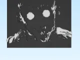 Hunter x Hunter gon rage Art-1