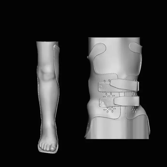Molds for medical protective gear