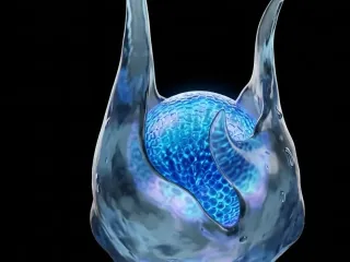 dragon tear 