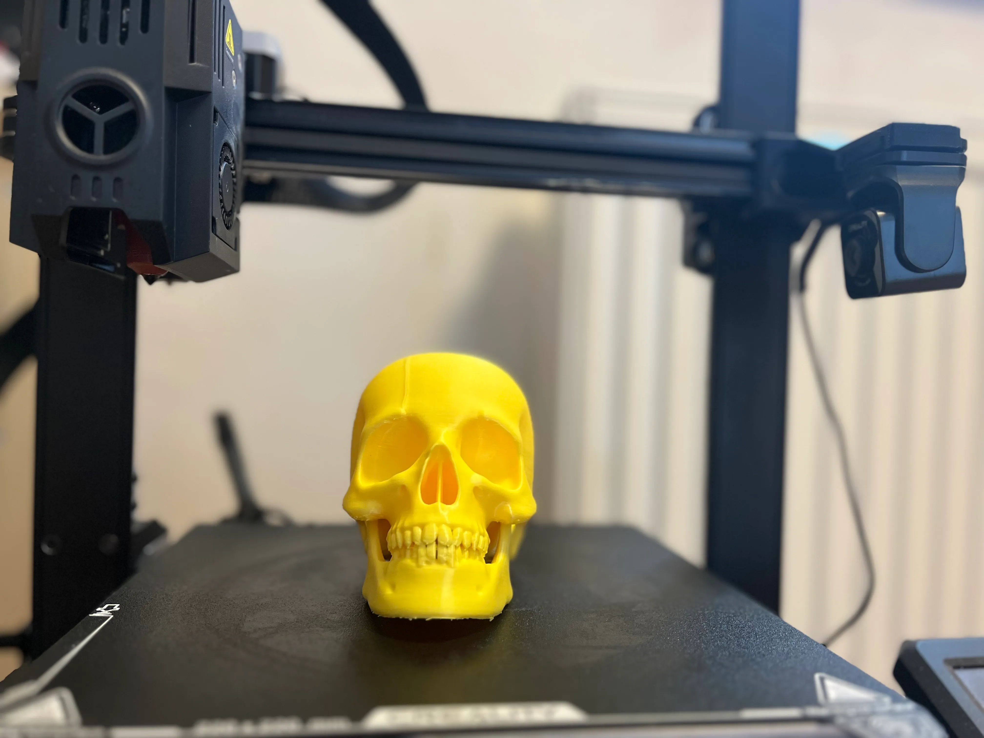 Human skull