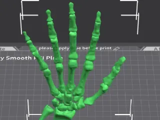 hand bones from NIH