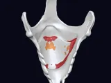 MASK Joker-2