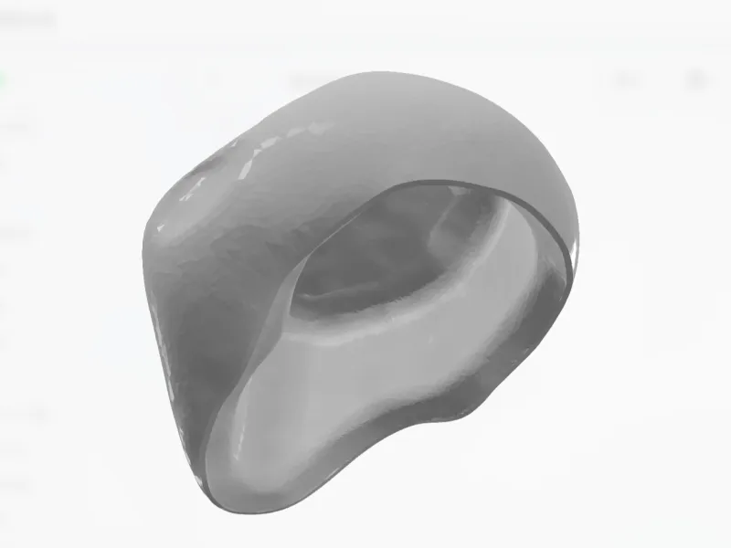 齿科3d模型