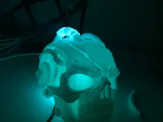 Cryo Skull