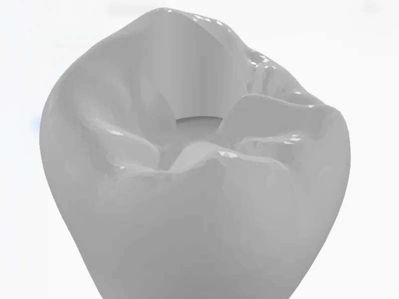齿科3d模型