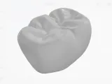 齿科3d模型-0