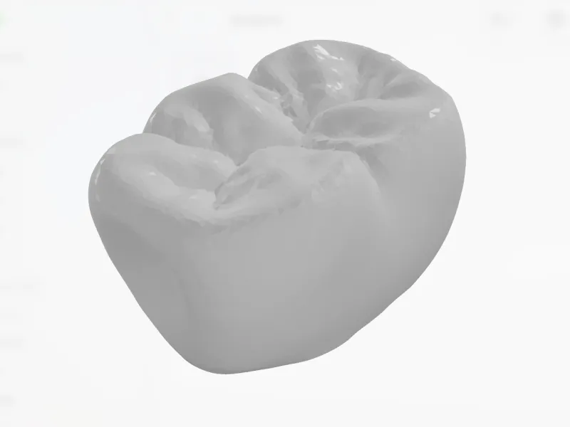 齿科3d模型