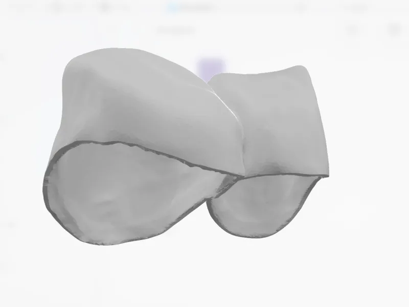 齿科3d模型