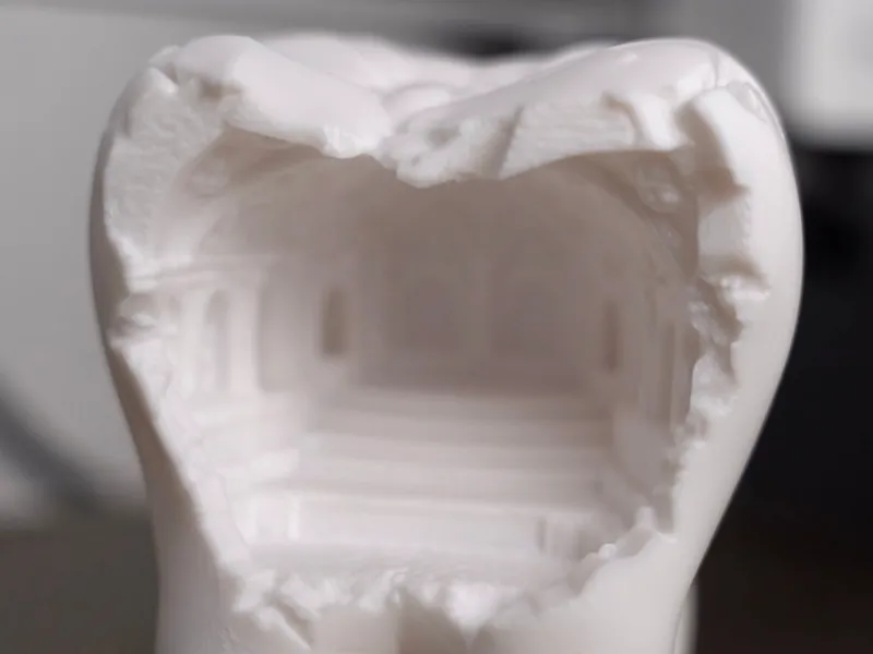 Tooth Artwork