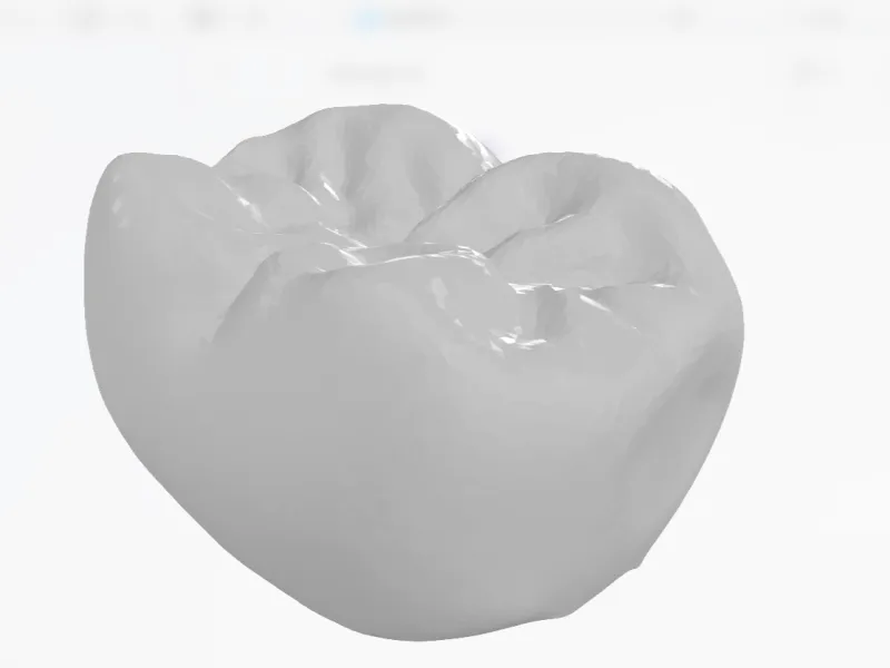 齿科3d模型
