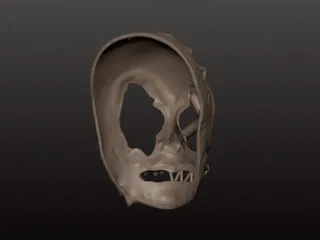 Stitches Mask