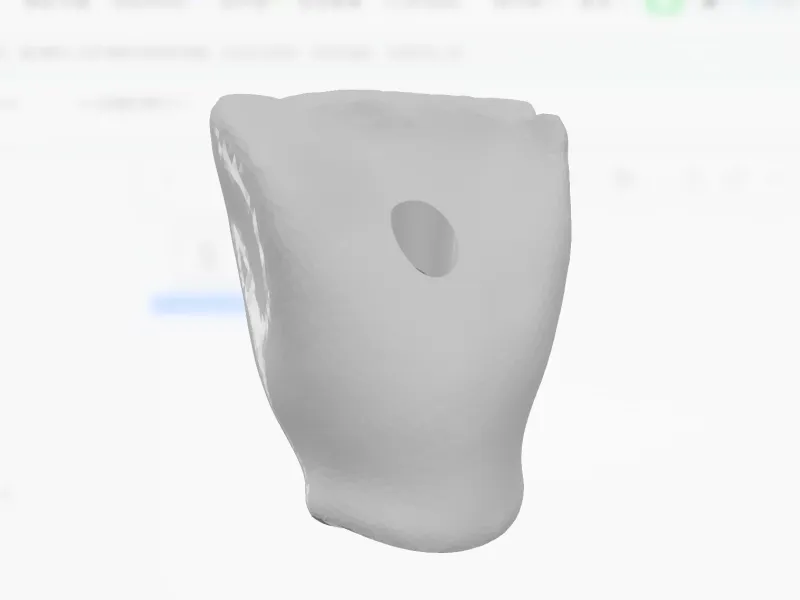 齿科3d模型
