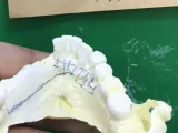 齿科3d模型-0