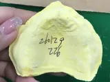 齿科3d模型-0